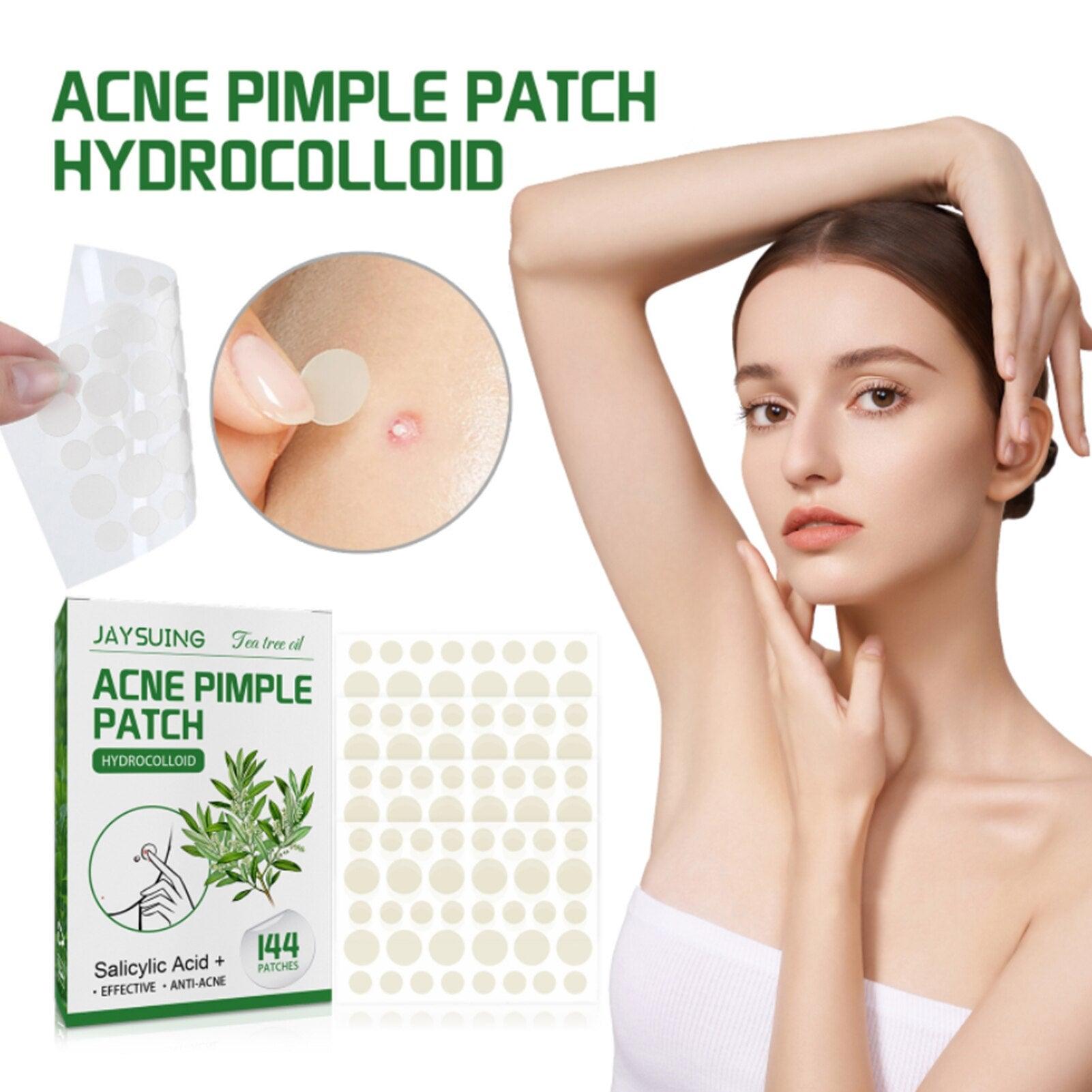 Acne Pimple Patches - ItemBear.com