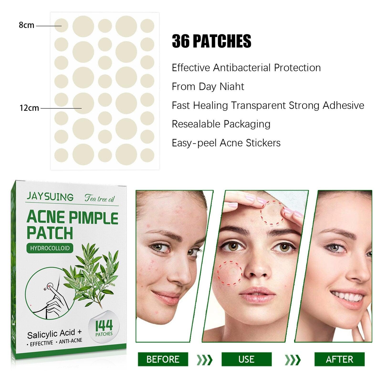 Acne Pimple Patches - ItemBear.com