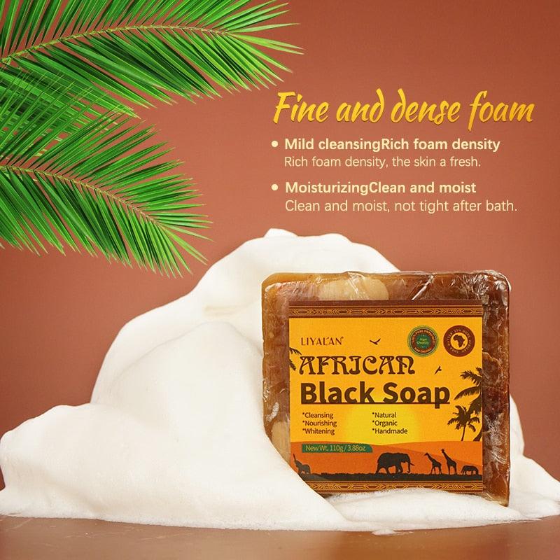 African Black Soap Handmade Organic Shea Butter Anti Rebelles Face - Premium Other from AliExpress Winners - Just $26.70! Shop now at ItemBear.com