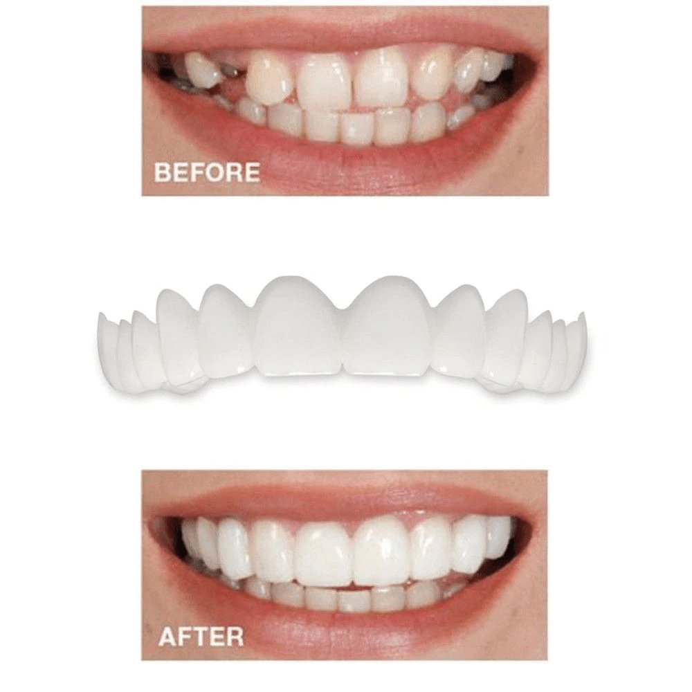 Instant Perfect Smile Dental Veneers - ItemBear.com