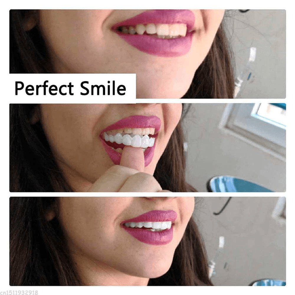 Instant Perfect Smile Dental Veneers - ItemBear.com